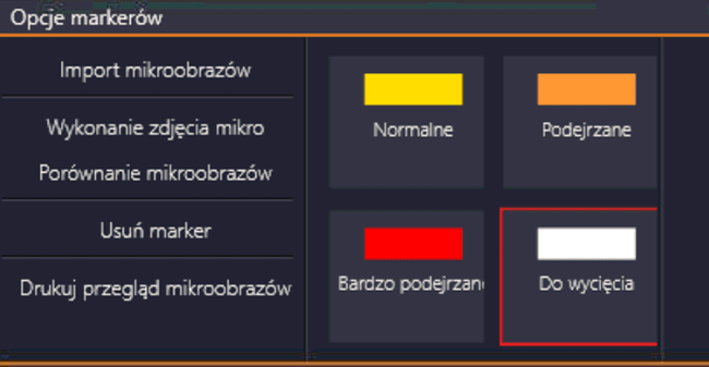 Możliwości opisu markerów podczas mapowania znamion.