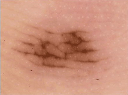 Wzorzec typu kratka (ang. lattice-like pattern - LLP)