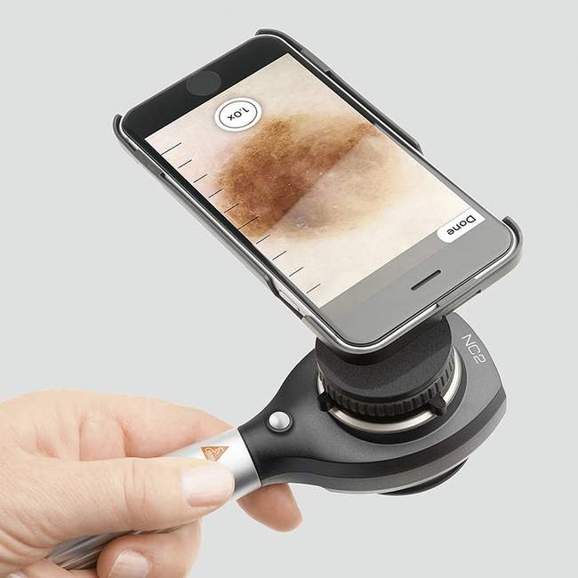 Dermatoskop ręczny Delta NC2, powiększenie do 10 x.