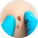 Obserwuj swoje znamiona