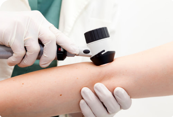 Badanie dermatoskopem ręcznym